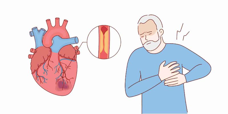 An overview of specific cardiovascular diseases